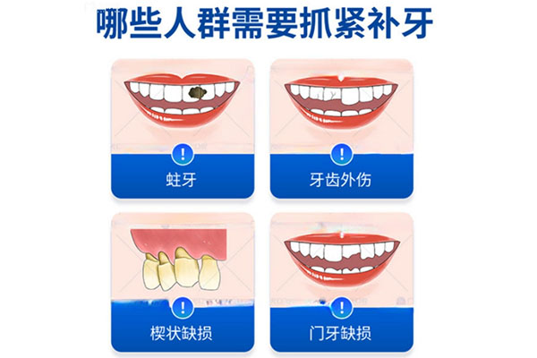 牙齿楔状缺损补牙后酸痛很久了怎么办呢(牙齿楔状缺损补牙后酸痛很久了怎么