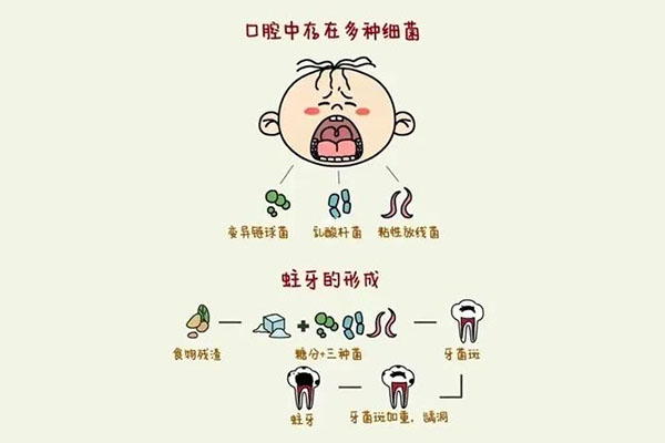 拔个虫牙要多少钱(拔个虫牙要多少钱一颗)