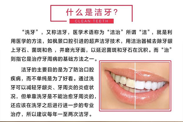 牙齿钙化是好事还是坏事呢(牙齿钙化是好事还是坏事呢怎么办)