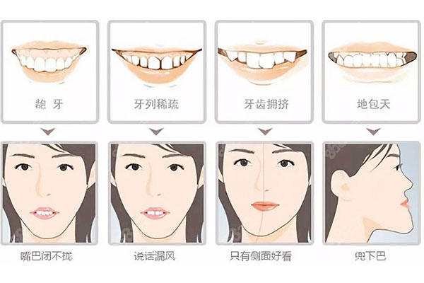 牙齿最近突然咬合不齐(牙齿最近突然咬合不齐了)一文了解详细