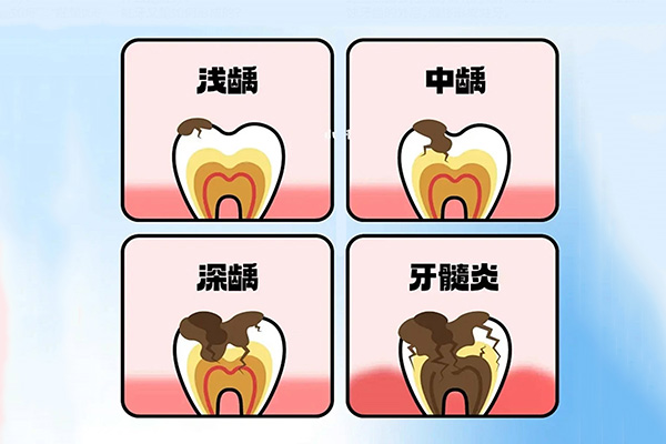 牙髓炎拔完牙髓还疼吗怎么办(牙髓炎拔完牙髓还疼吗怎么办呀)