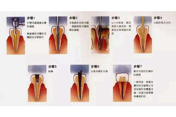 医院镶牙价钱表