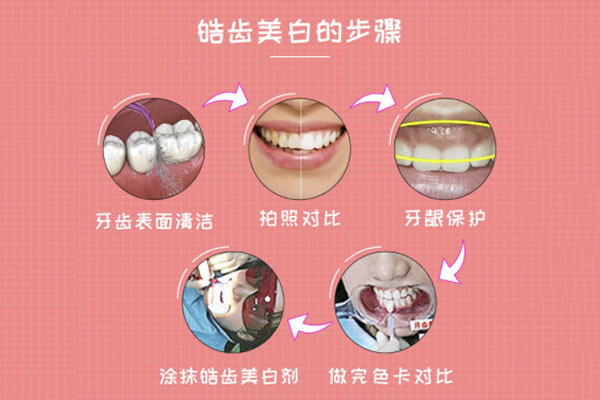 怎么去除烟渍黄牙垢小窍门(怎么去除烟渍黄牙垢小窍门视频)