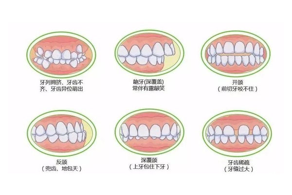 牙齿不齐可以磨牙矫正吗多少钱(牙齿