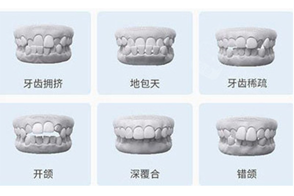 虎牙不矫正可以吗(虎牙不矫正会怎么样)