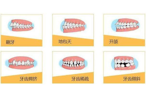 牙齿不齐好不好印象八字文(牙齿不齐