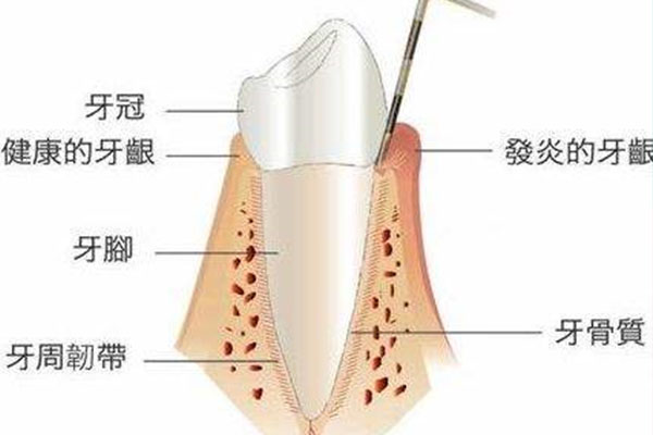 80岁老人掉牙正常吗(80岁老人掉牙正常吗图片)