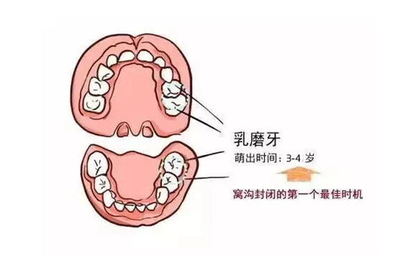 六龄齿坏死拔掉最佳时期是几岁左右(六龄齿坏了可以拔掉吗)