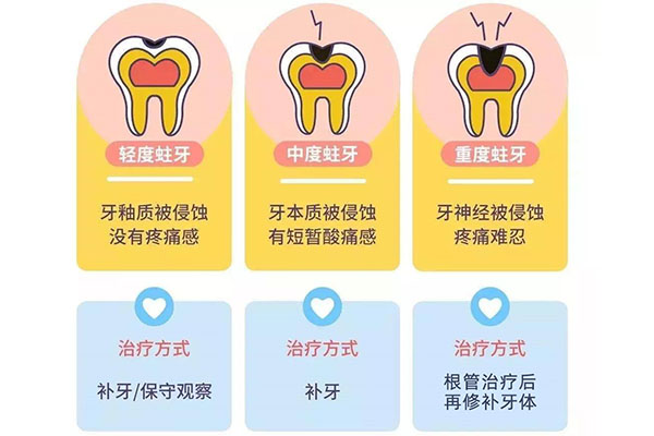 虫牙吃了一半 补好还是拔好(虫牙吃的快没了 除了拔牙没办法吗)