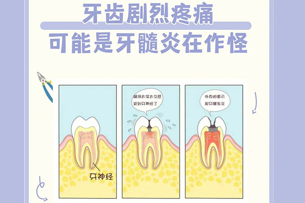 急性牙髓炎为什么夜间疼痛加剧(急性牙髓炎为什么夜间疼痛加剧呢)