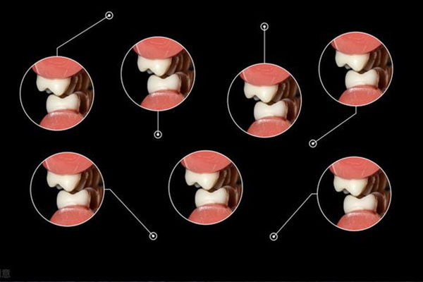 牙齿突然咬合不齐是什么原因导致的怎么治疗(牙齿突然咬合不齐