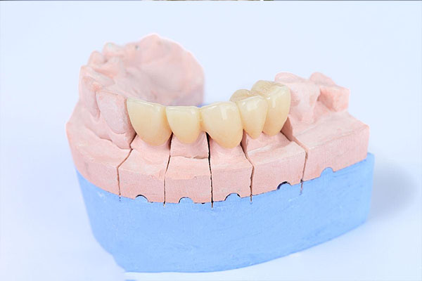 一次性修牙工具多少钱(修牙一次性工具包有什么)