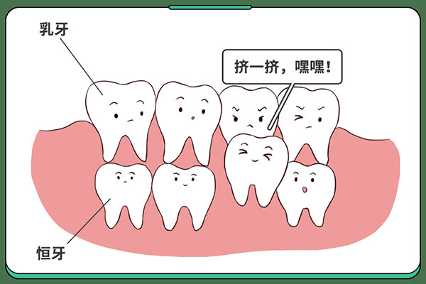 乳牙滞留 双排牙怎么处理的(乳牙滞留 双排牙怎么处理的视频)