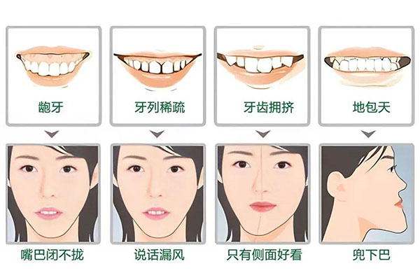 30岁牙齿不齐如何纠正(30岁牙齿不齐如何纠正图片)一文熟识全面