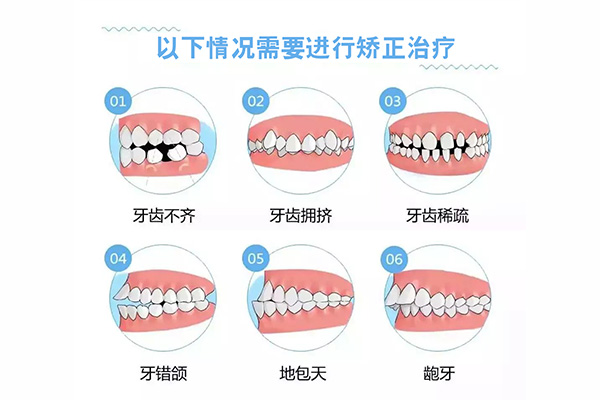 长虎牙有好处吗(长虎牙有好处吗视频)