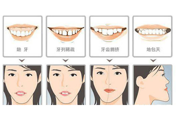 反颌啥意思(反颌是什么原因造成的)技术含量高