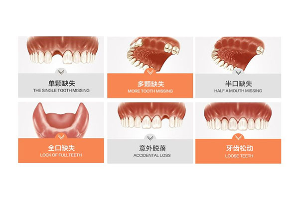 坏牙会自己脱落然后痊愈吗(坏牙会自己脱落然后痊愈吗)