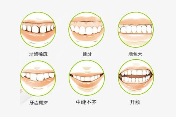 门牙不齐怎么修复(门牙不齐怎么修复