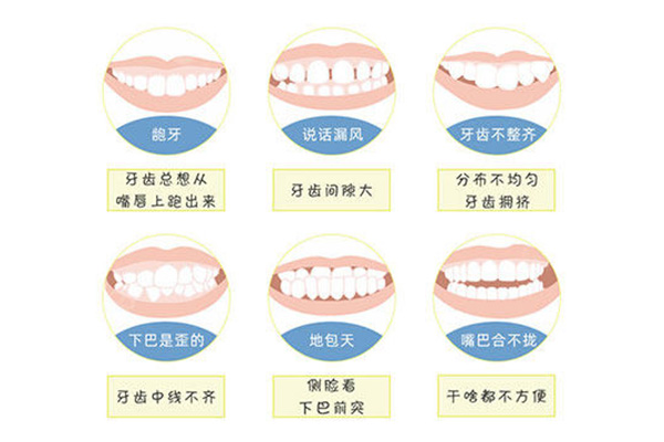 小孩虎牙没掉,外侧又长一颗,怎么办(孩子虎牙没掉长在牙龈上以