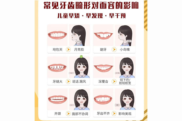 小孩牙齿反颌怎么办(小孩子牙齿反颌