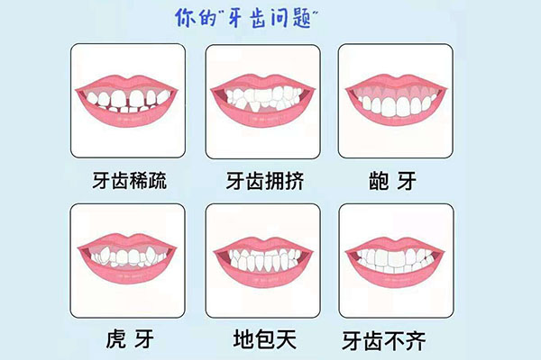 女孩门牙不齐好不好(女孩门牙不齐好不好看)一文通晓