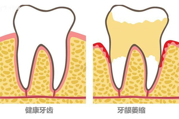 宝宝牙齿很黄,牙齿上有污垢,怎么办(宝宝牙齿黄渍)