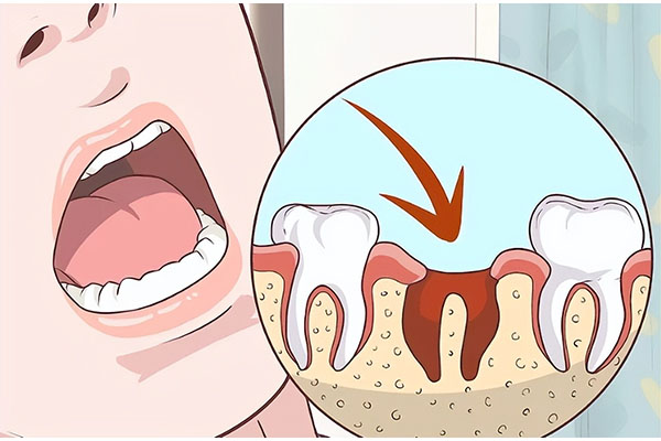 牙拔掉牙神经还在吗(牙拔了牙神经还在吗)