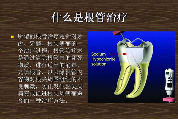 做根管治疗针断在里面,又把牙跟打穿了算医疗事故(根管治疗针断在牙齿里面