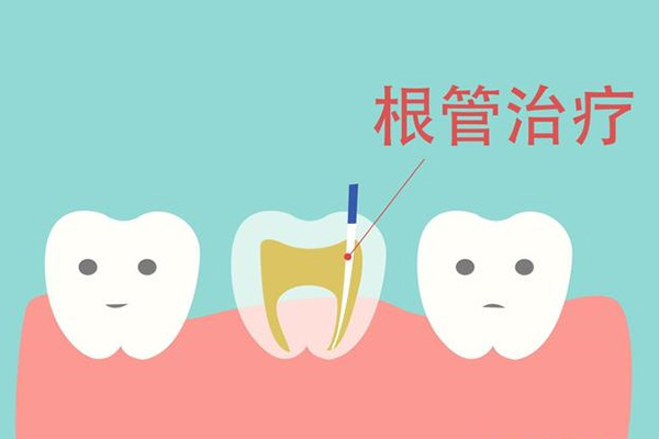 做过根管冶疗的牙齿根尖炎(做过根管冶疗的牙齿根尖炎怎么治疗)