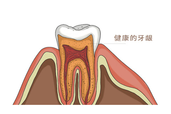 牙根尖炎牙床上长了个脓包怎么办(牙根尖炎牙床上长了个脓包怎么办图片)