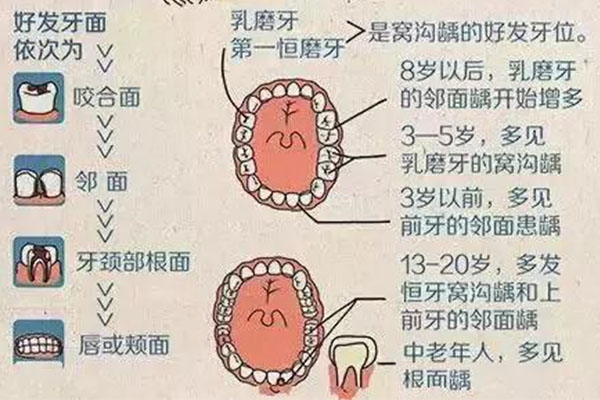 门牙靠近牙龈那里有个小坑洞(门牙靠近牙龈那里有个小坑洞可以