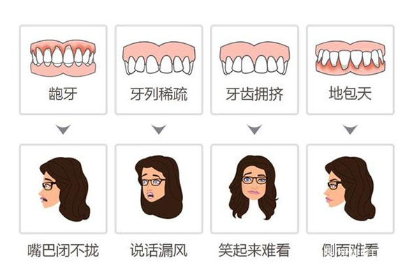 50岁牙齿不齐除了矫正还有什么办法吗