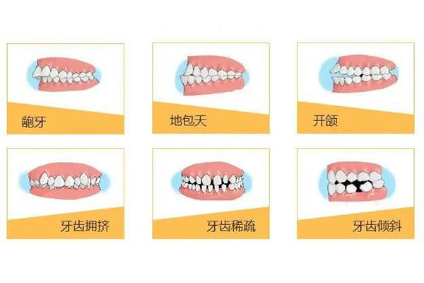 只有一颗牙齿不齐矫正需要多长时间