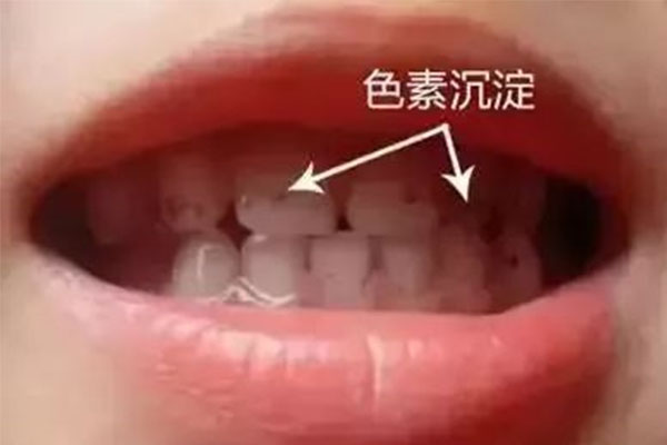 做蛋糕的食用色素安全吗(做蛋糕的食用色素安全吗知乎)