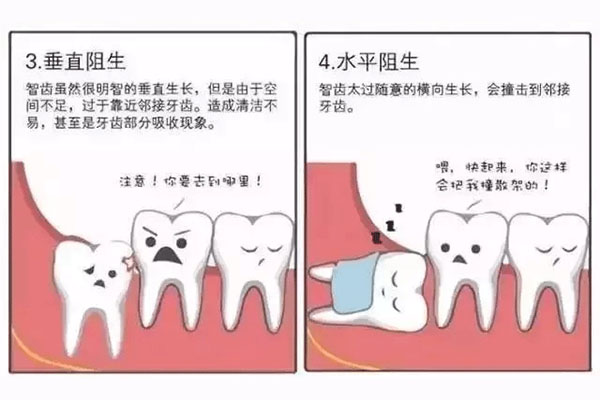 成人智齿活动了自己会掉吗(成人智齿活动了自己会掉吗)