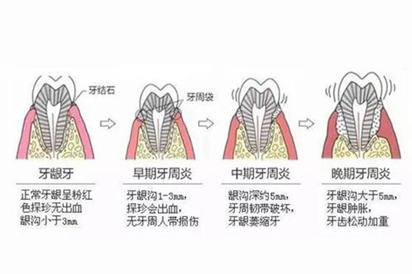 南京市口腔医院牙周病科哪个医生好(南京市口腔医院牙周病科哪