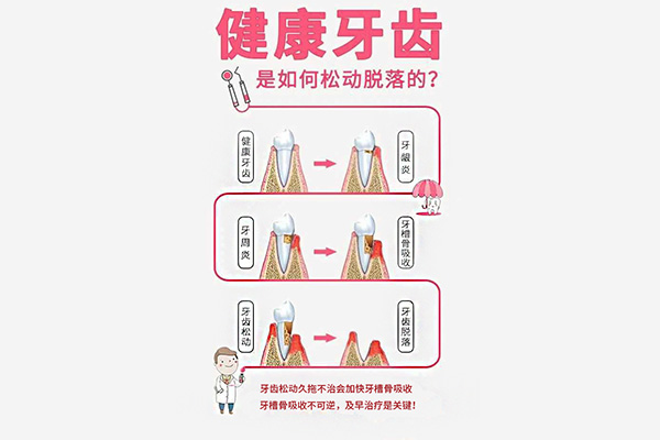 成人掉牙齿是什么原因导致的(成人掉牙齿是什么原因导致的图片