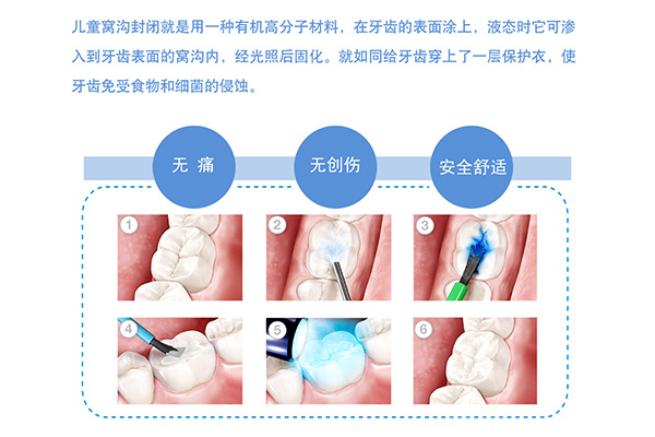 窝沟封闭广告语(窝沟封闭宣传标语)