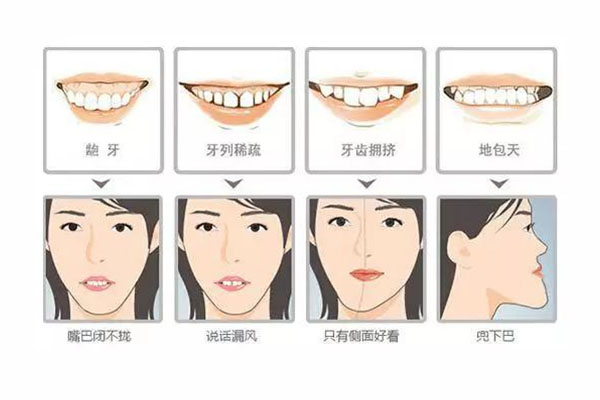 牙不齐说说(牙齿不整齐的说说)一文熟识准确