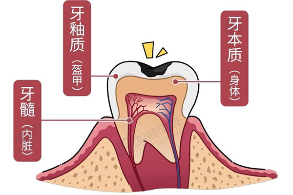 牙体缺损修复体的类型(牙体缺损修复体的类型有哪几项)