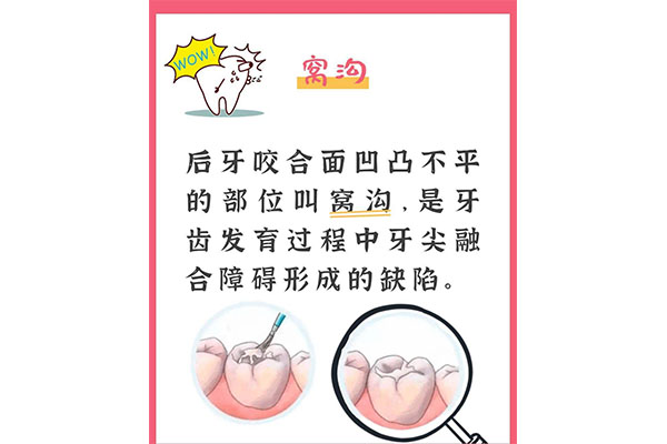 小孩牙齿涂氟对身体有影响吗播放(小孩牙齿涂氟有副作用吗)