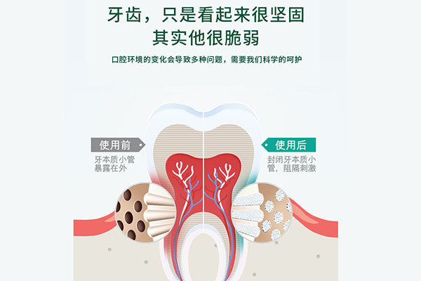 乳牙孩子做窝沟封闭的利弊(乳牙做窝沟封闭好吗)