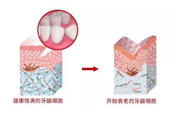 30岁牙龈萎缩牙齿松动正常吗怎么治疗(30岁牙龈萎缩牙齿松动正