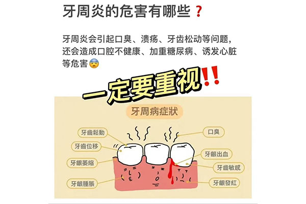 牙周治疗的价格是多少钱啊(牙周治疗