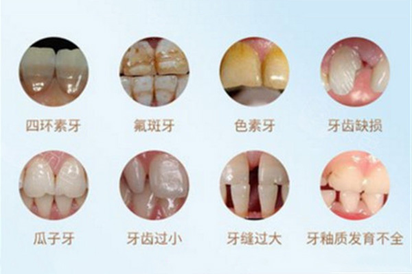 女生牙齿越来越黄是什么原因