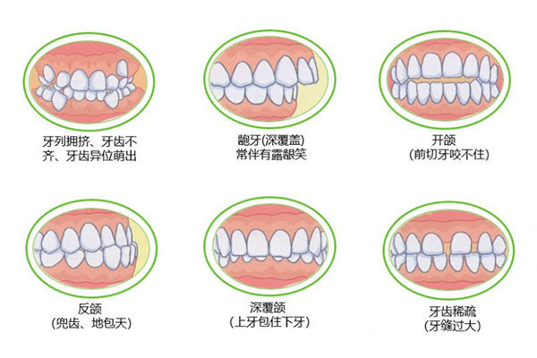 牙齿不齐嘴歪脸不对称(牙齿不齐嘴歪