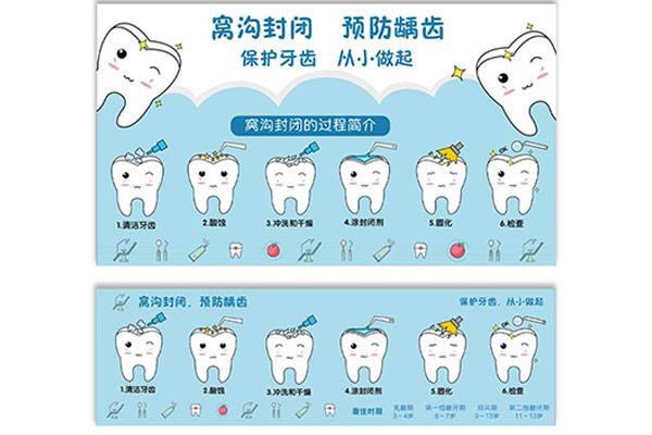 牙医涂氟什么牌子好(牙医涂氟什么牌