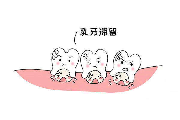 乳牙滞留应该怎么办呢吃什么药最好