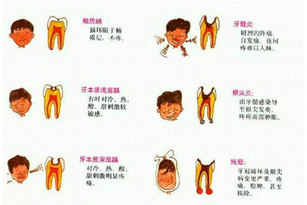 牙周炎抹药之前不疼后来疼(牙周炎抹药之前不疼后来疼了)