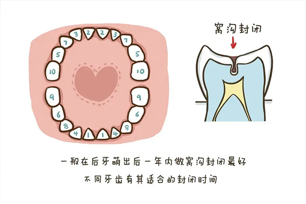 儿童涂氟的步骤包括(儿童涂氟的步骤